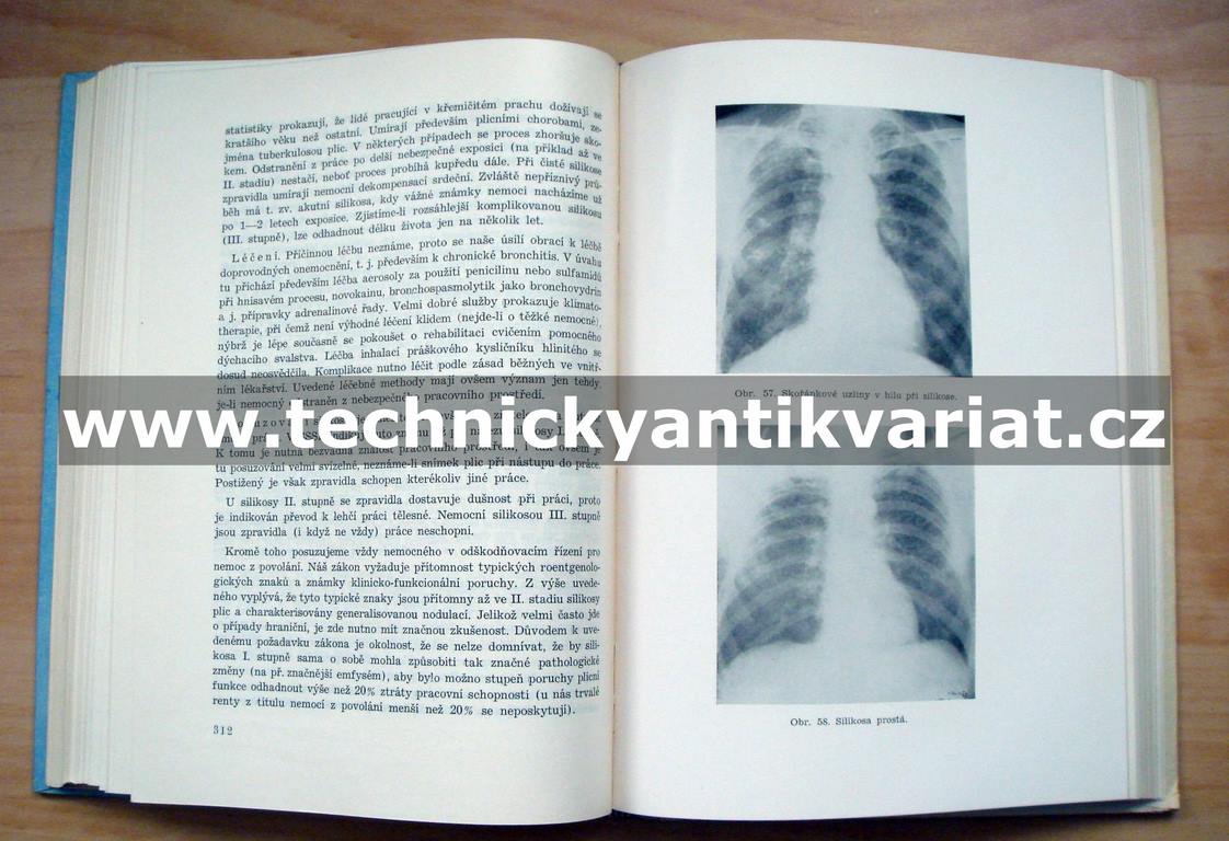 Hygiena práce a choroby z povolání